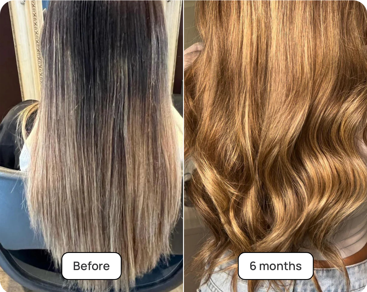 Hair Burst The Chewable Hair Growth Starter Kit