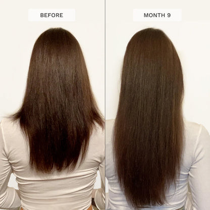 Hair Burst Chewable Hair Vitamins 60pes